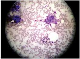 Acid-fast Staining Procedure for Project